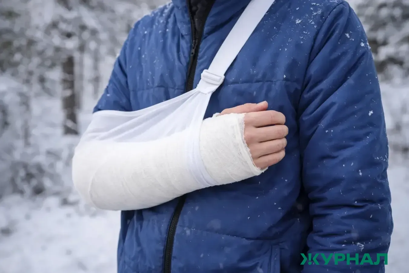 В Саратове в феврале зафиксировано 962 травмы из-за падений на улицах